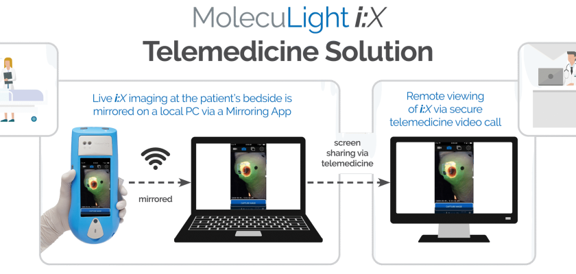 i:X® Telemedicine Solution - MolecuLight